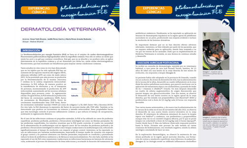 C. Yotti , J. Pérez & M. Pérez-Aranda.  Vasculitis auricular postvacunal.